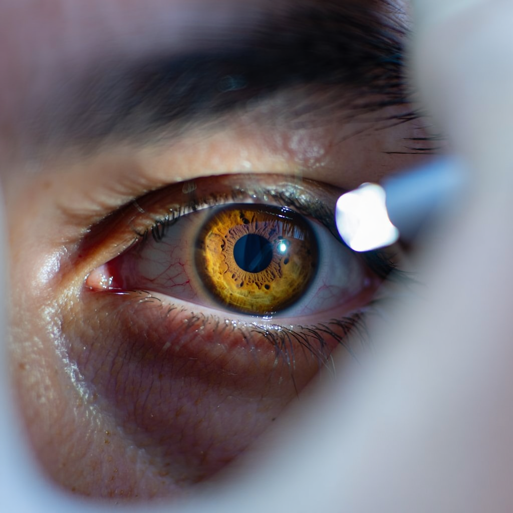 Glaucoma risk assessment at Shine Eye Clinic